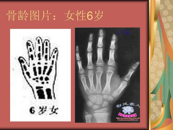 六岁孩子什么礼物合适，六岁孩子骨龄正常范围
