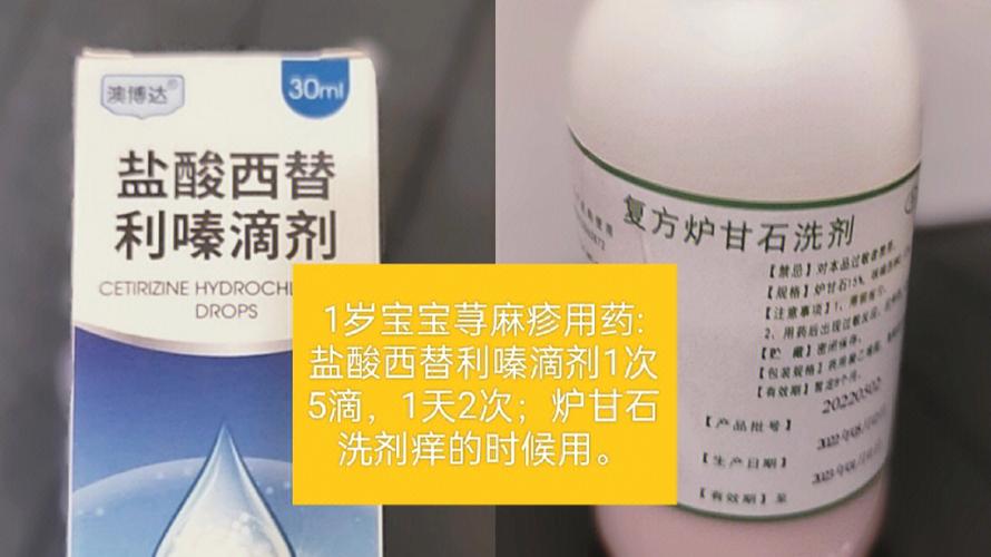 一周岁孩子送什么比较好,一周岁孩子荨麻疹怎么治疗