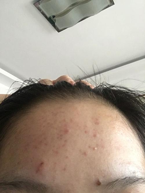 十二三岁女孩子送什么礼物,十二三岁的女孩子长痘痘什么原因