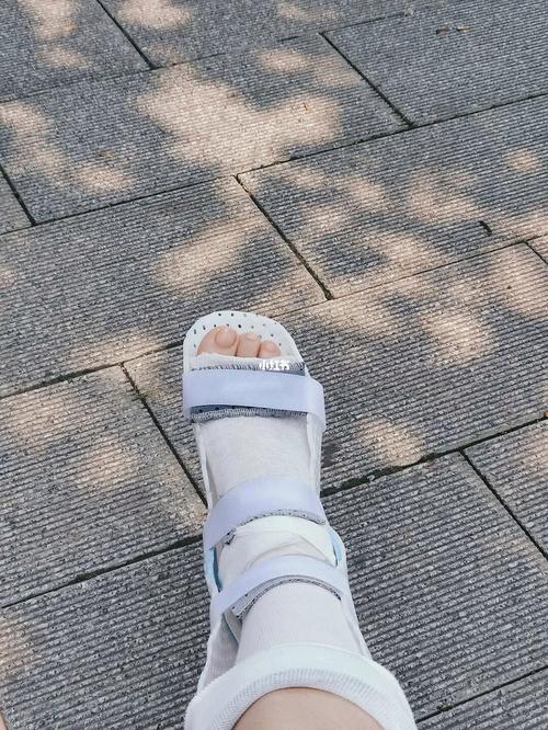 客户骨折了送什么礼物，客户骨折了送什么礼物好，好朋友胳膊断了，准备去看望他送什么好呢？